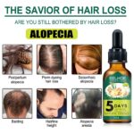 Eelhoe Ginger Hair Essential Oil. Eelhoe Ginger Hair Essential Oil - Image 3