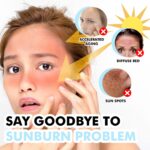 Hoygi Hyaluronic Acid Sunscreen Stick Gentle Moisturizing UV Protection For Sunburned And Reddened Skin - Image 3