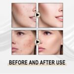 Jaysuing Lactobionic Acid Liquid Exfoliating Blackheads Shrinking Pores Cleansing Moisturizing Skin - Image 4