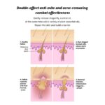 Jaysuing Acne Removing Mite Skin Soap Acne Inhibiting Cleansing Mite Handmade Soap - Image 5