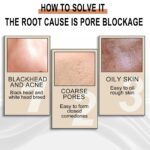 Jaysuing Lactobionic Acid Liquid Exfoliating Blackheads Shrinking Pores Cleansing Moisturizing Skin - Image 2
