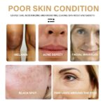 EELHOE Turmeric Dark Spot Correction Face Care Spot Moisturizing And Repairing Skin Tone Serum - Image 6
