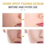 Eelhoe Turmeric Exfoliating Facial Scrub For Deep Cleansing Of Delicate Pores And Beauty Cleansing Treatment - Image 5