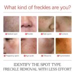 EELHOE Color Repair Cream Replenishes, Moisturizes, And Lightens Freckles, Black Spots, Blemishes, Melasma, And Melanin Skin Cream - Image 2