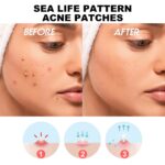 Hoygi Cute Colorful Acne Patches Reduce Acne & Pimples Anti-Dryness Deep Hydration Facial Cleansing - Image 5