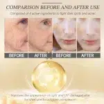 Retinol Face Serum Facial Dark Spot Remover Fade Acne Marks Moisturizer Smooth Skin Hydrating Beauty Health Skin Care Essence - Image 3
