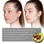 Retinol Face Serum Facial Dark Spot Remover Fade Acne Marks Moisturizer Smooth Skin Hydrating Beauty Health Skin Care Essence - Image 6